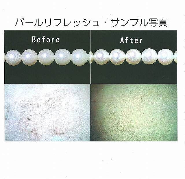 真珠のエステ